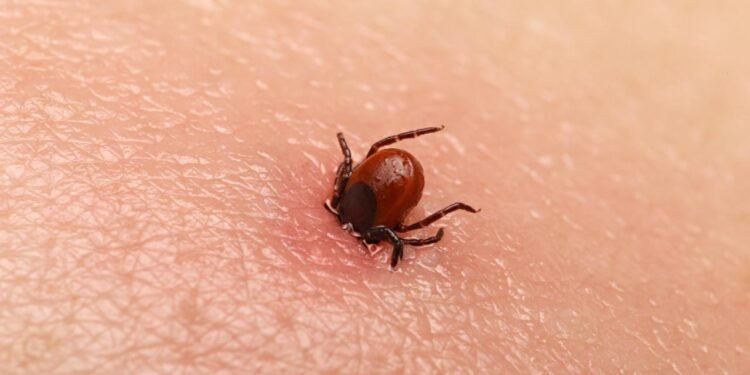 Kene Isırığı Sonrası İşitme Kaybı: Bir Vaka Raporu